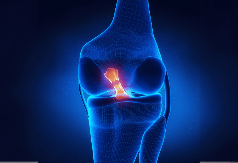 Especialista en lesion de ligamentos Queretaro