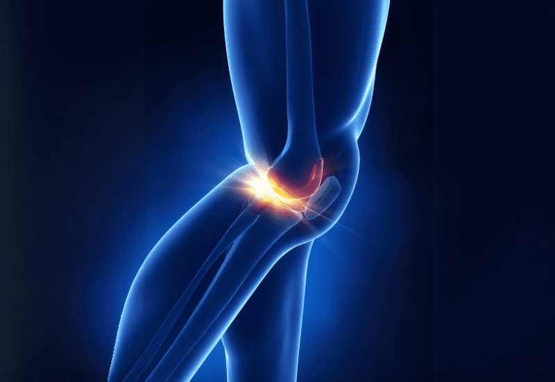 Especialista en lesion de meniscos Queretaro