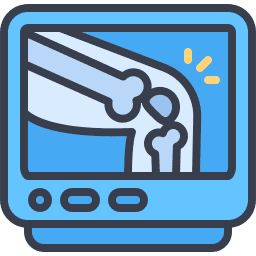 Precio de Rayos X para lesiones de rodilla Queretaro